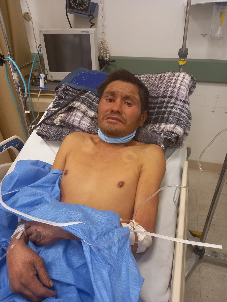SaludZapopan's tweet photo. #Comparte y ayúdanos a localizar a la familia de Miguel Ángel, quien refiere ser originario de Xalapa, Veracruz y tener como apellidos Cruz Hernández o Cruz Martínez.

Desde el pasado 11 de enero es atendido en la Cruz Verde Villa de Guadalupe. Comunicarse al 3336251328. https://t.co/GYrltjhxO2