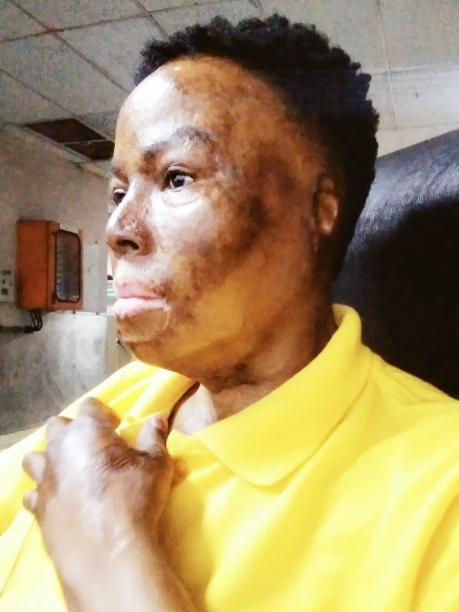Misst_Thembs's tweet photo. I stayed... And you don't have to.. Walk while you can

Don't be a statistic.... 🌻 🌻 🌻 https://t.co/jHxS6k0bSR