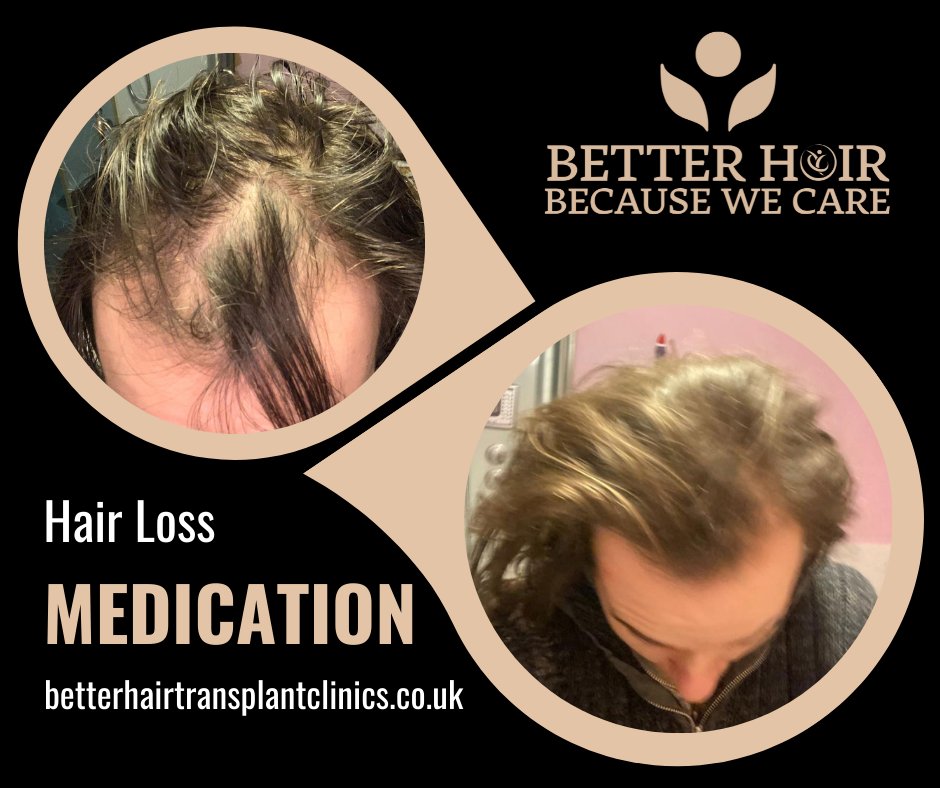 BetterHairClinics on Twitter: BetterHairClinics on Twitter: