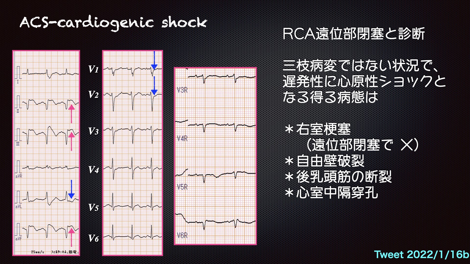 N. Tsukishima EP大学心電図検定学部試験対策科担任 على X