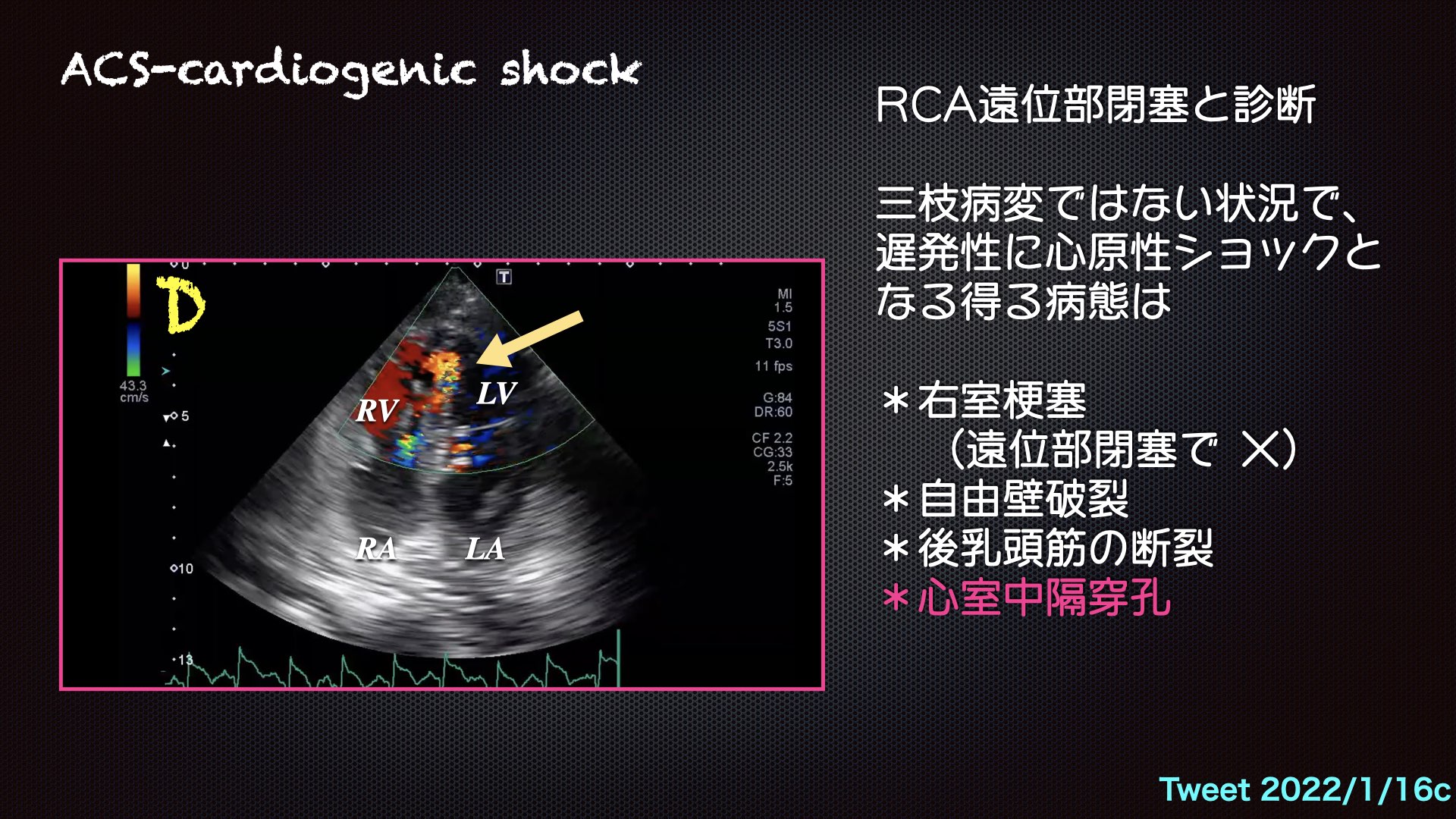 スマートウォッチ 心電図 ECG 通話機能 血圧 血中酸素 心拍数