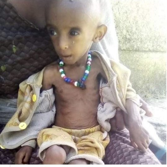 SamBekeleGerba's tweet photo. Whenever we sit to dine let’s remember these kids from Tigrai! They don’t know about Debretsion or Abiy, they don’t have any say in this war but they are  number 1 victim of the war. @AbiyAhmedAli could end this starvation in a minute. But he chose not to. Always Remember That! https://t.co/dJqVFeaffE