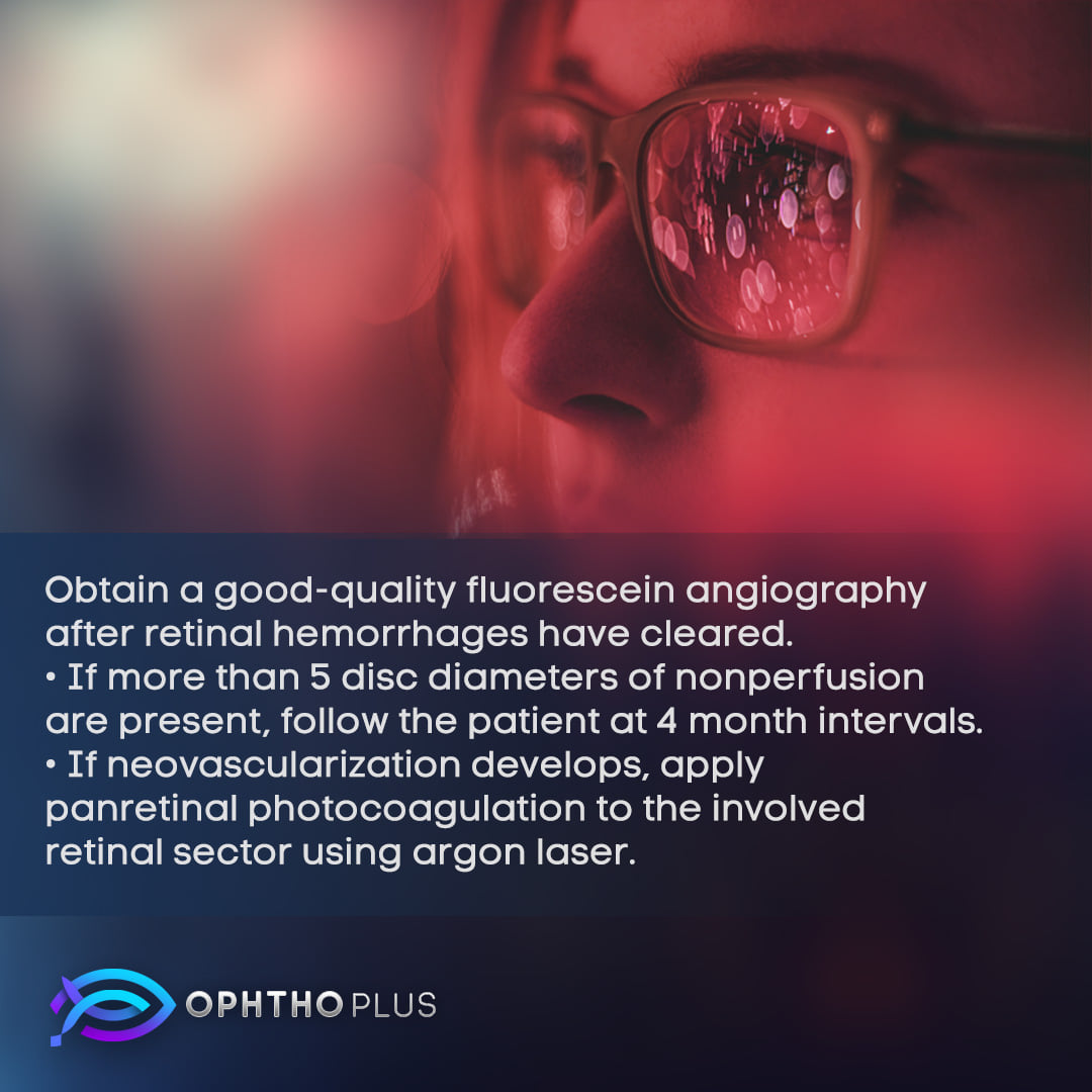 ophthoplus's tweet image. #BRVO
#retina
Branch Retinal Vein Occlusion (BRVO) management ⬇️
Visit our Instagram account: ⬇️
instagram.com/ophthoplus
Our Facebook page: ⬇️
facebook.com/ophthoplus