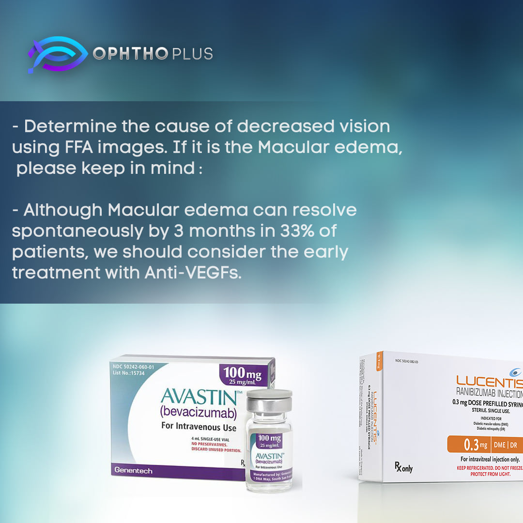 ophthoplus's tweet image. #BRVO
#retina
Branch Retinal Vein Occlusion (BRVO) management ⬇️
Visit our Instagram account: ⬇️
instagram.com/ophthoplus
Our Facebook page: ⬇️
facebook.com/ophthoplus