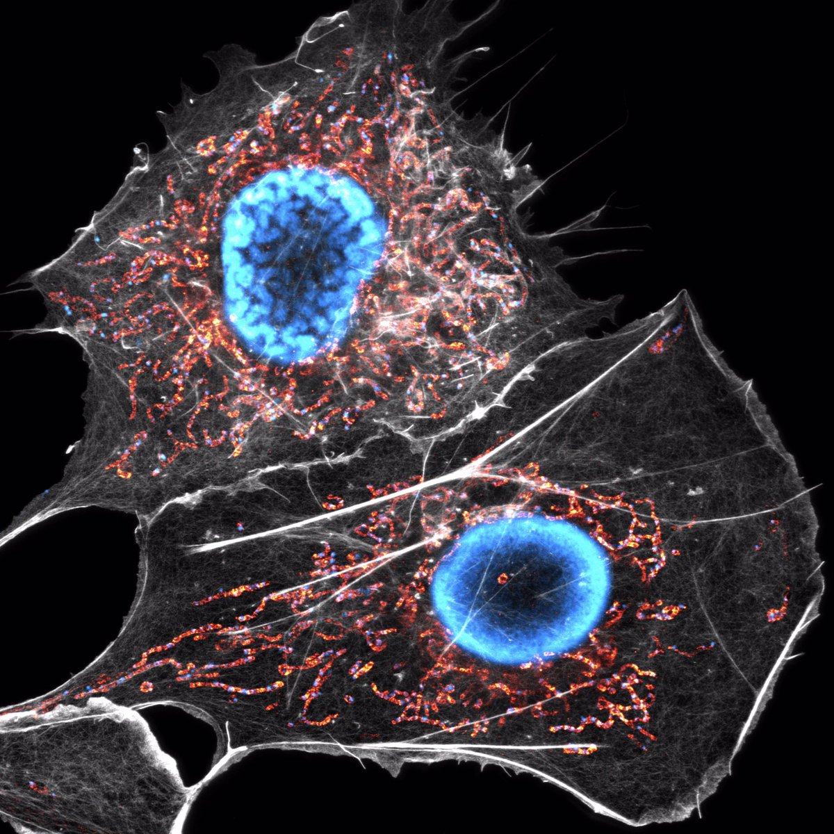 stephan_till's tweet photo. Mitochondrial network covered with dense actin fibers in a COS-7 cell. #Microscopy #mitochondria #cytoskeleton https://t.co/A3l7ljmP7e