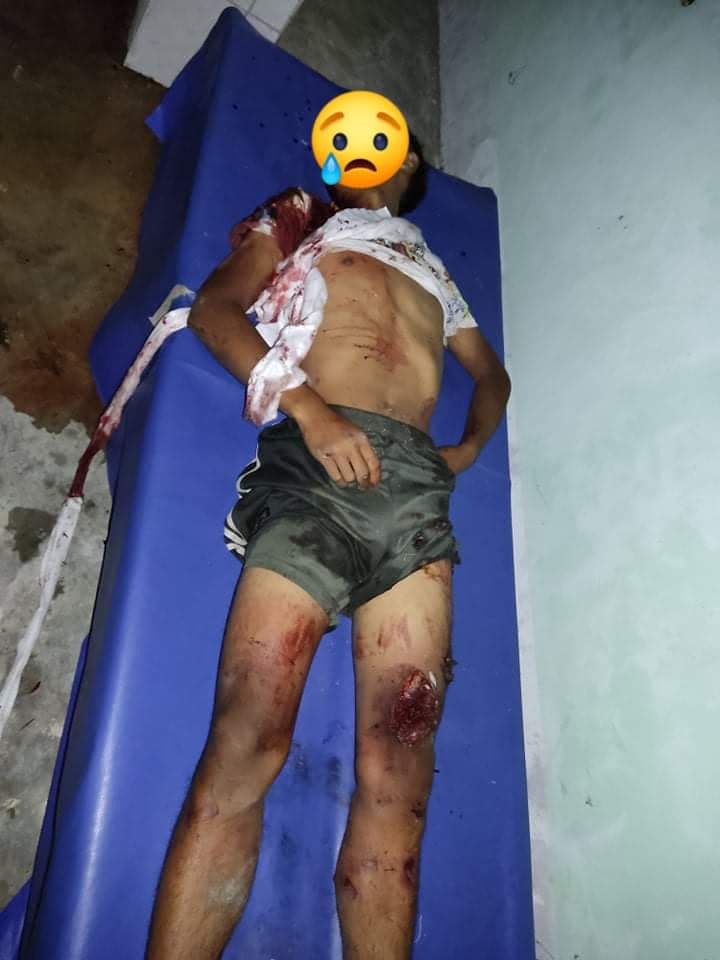 spring_2021's tweet photo. TW//Death/Blood

Two fighter jets from SAC fired to NangMaeKhon,Demoso Tsp at around 5:40pm despite there was no fighting – killing 3 young philanthropists. Airstrikes on  non-combatant area by SAC, targeting civilians were a war crime.

#2022Jan16Coup
#WhatsHappeningInMyanmar https://t.co/uZcZzwNtF8