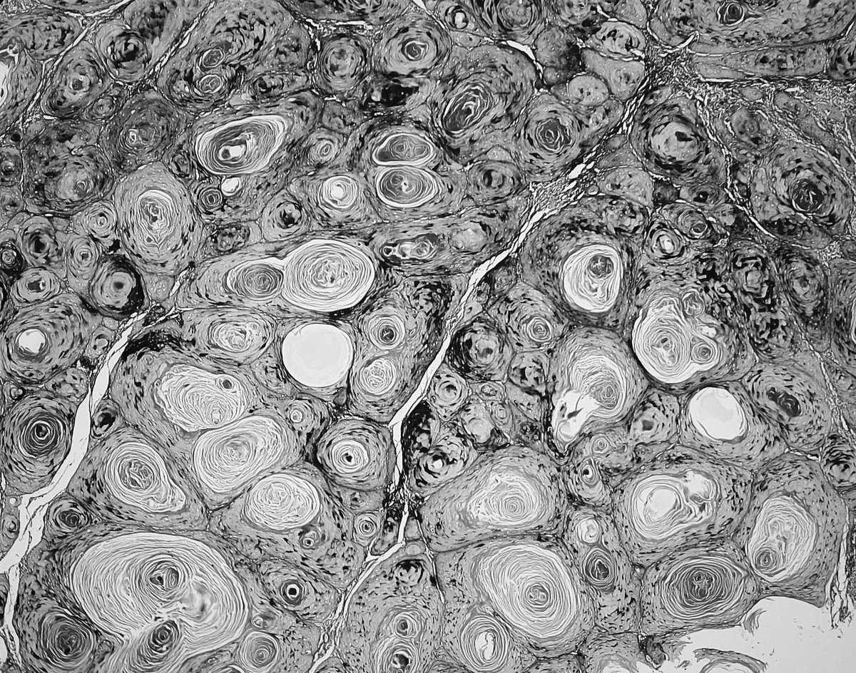 padmapathology1's tweet photo. #pathology can warm my ❤️ and hypnotize me anyday..
#ILookLikeAPathologist 
#PathLife https://t.co/R2pdWf1ulF