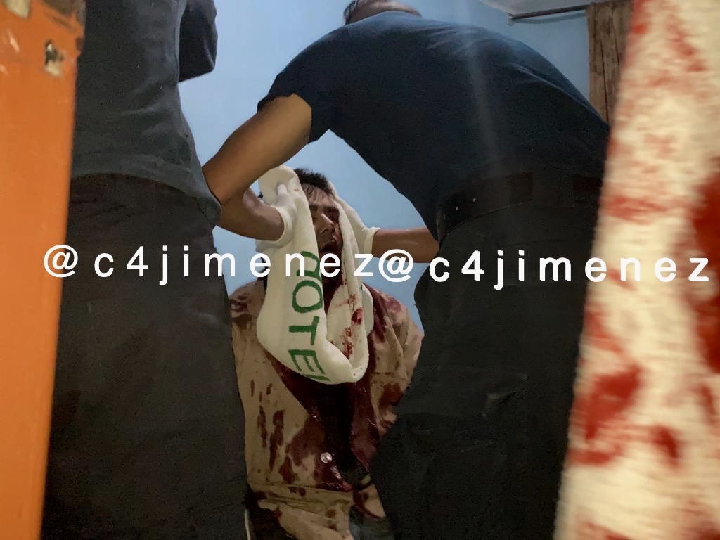 ELLOS  QUEDARON HERIDOS JUNTO CON <a href="/natalia_lane/">Natalia Lane</a>
Jonathan de 19 años
Vetarino de 60
Gerardo 41
Cuando un sujeto la atacó en este hotel de Tlalpan, en <a href="/BJAlcaldia/">Alcaldía de Benito Juárez</a>, los 3 fueron a apoyarla.
Así terminaron todos heridos.
La @fiscaliacdmx y <a href="/SSC_CDMX/">SSC CDMX</a> ya rastrean al agresor.