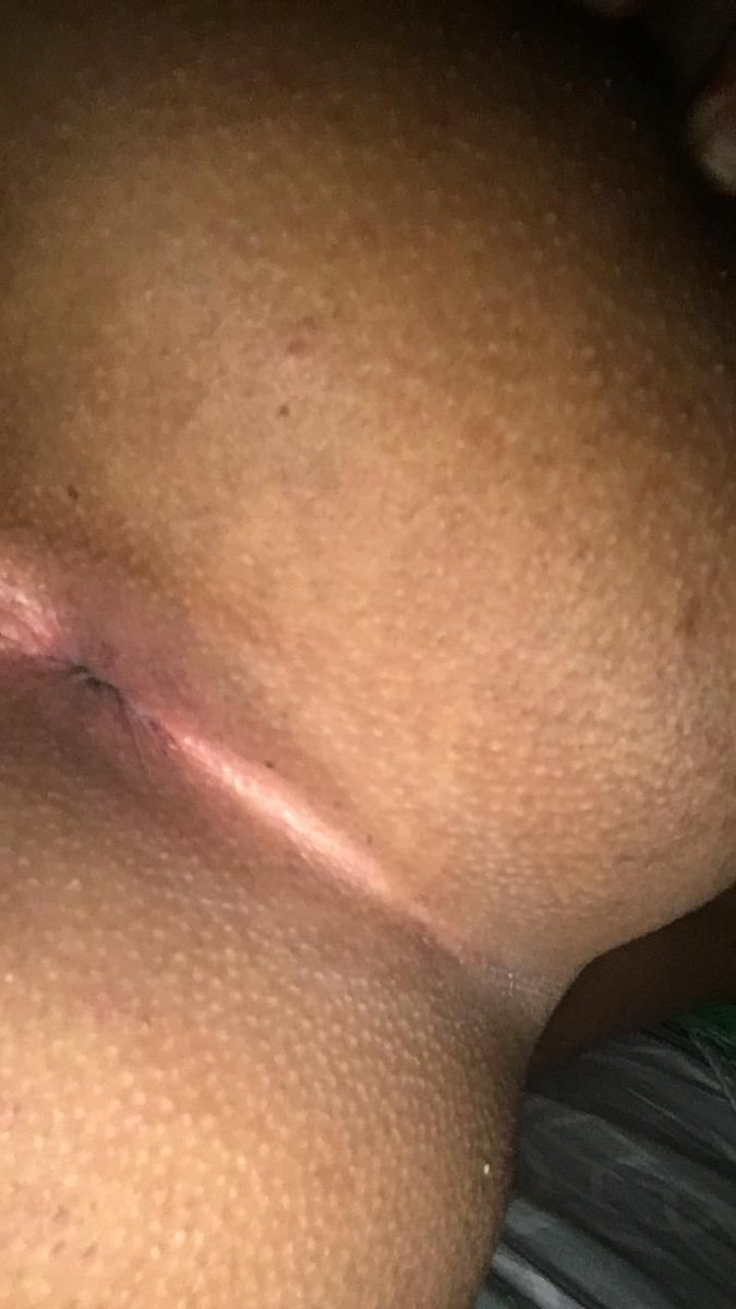 Luizphysihot's tweet photo. Depilação check ✅ totalmente sem pelos 👌🏽

#BitchBrisada @PutariazinhaRj @Soltaputaria2 @Safadezas0 https://t.co/kreL1OYol2