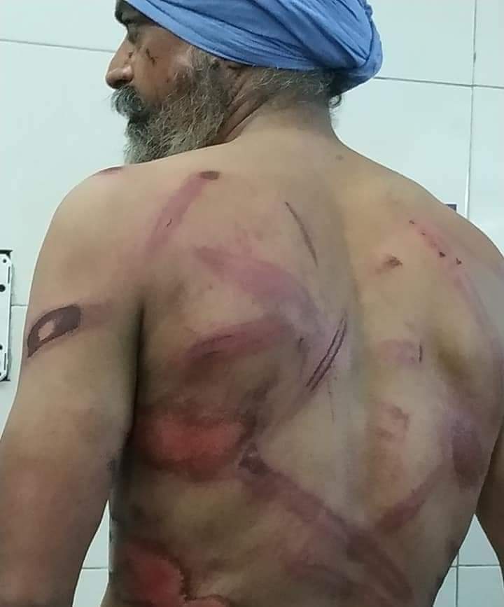 We Support Farmers
#NoVoteToBJP