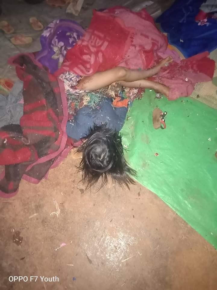 Breaking News- ဖရူဆိုရှိ စစ်​ဘေး​ရှောင်စခန်းကို နံနက် ၁ နာရီအချိန် စစ်တပ်က ​လေယာဥ်ဖြင့် ဗုံးကျဲ၊ ၇ နှစ်အရွယ် သမီးငယ် အပါအဝင် စစ်​ဘေး​ရှောင်ပြည်သူ ၃ ဦး ပွဲချင်းပြီး​သေဆုံး
ရန်ကုန်၊ ဇန်နဝါရီ ၁၇ 

Read More -> t.me/khitthitnews/2…