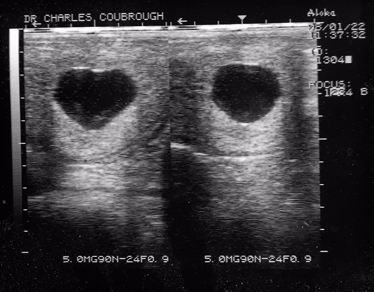 CharlesDVM's tweet photo. Para el #lunesdecaballos lluvioso tengo las primeras preñeces del 2022 #ecografía #ulrasonogramas #reproduccionequina https://t.co/4pHqq9E0E4
