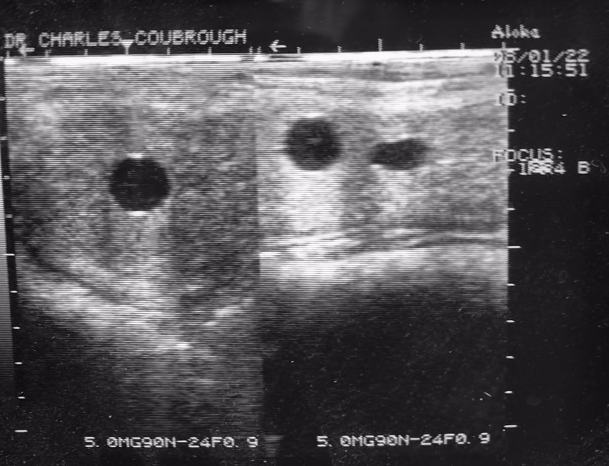 CharlesDVM's tweet photo. Para el #lunesdecaballos lluvioso tengo las primeras preñeces del 2022 #ecografía #ulrasonogramas #reproduccionequina https://t.co/4pHqq9E0E4