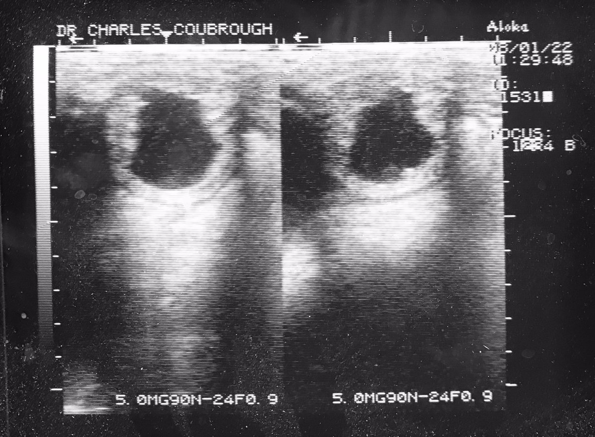 CharlesDVM's tweet photo. Para el #lunesdecaballos lluvioso tengo las primeras preñeces del 2022 #ecografía #ulrasonogramas #reproduccionequina https://t.co/4pHqq9E0E4