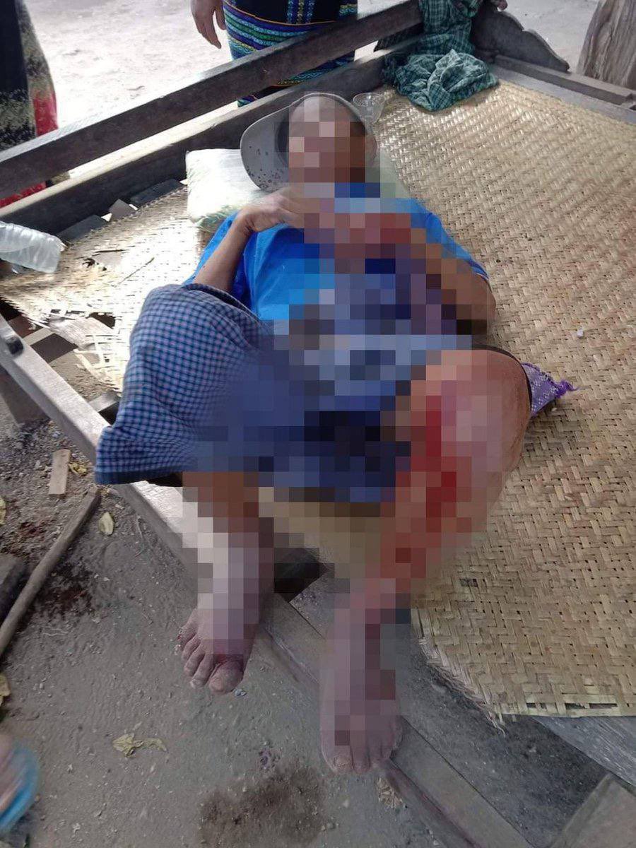 SAC stormed KyaungWinDuu &amp; AungChanThar villages in Pale Tsp on Jan 16 morning &amp; fired heavy artillery shells, gunshots - injuring some locals &amp; forcing locals to flee as SAC stationed in the village. #SanctionMOGE #2022Jan17Coup #WhatsHappeningInMyanmar