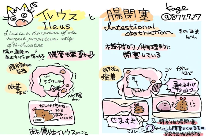 【イレウスと腸閉塞めもver.2】
イレウス:腸管蠕動の機能低下。麻痺性イレウス
腸閉塞:腸管が機械的・物理的に閉塞している。
腫瘍により閉塞する閉塞性腸閉塞、
血流障害を伴う絞扼性腸閉塞 