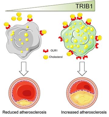 URGworld's tweet photo. Impact of TRIB1 on Atheroscerosis https://t.co/IXCiAcd1fb