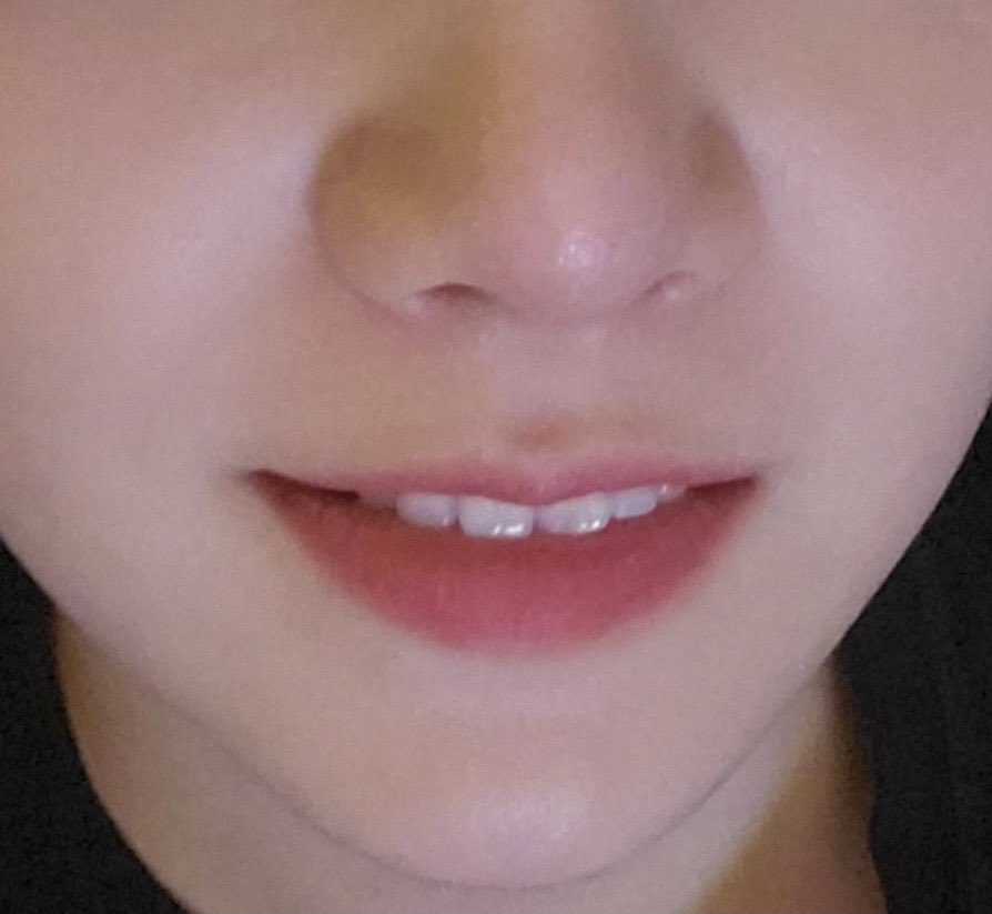 btslipsarchive's tweet photo. https://t.co/BGOa6KtAu9