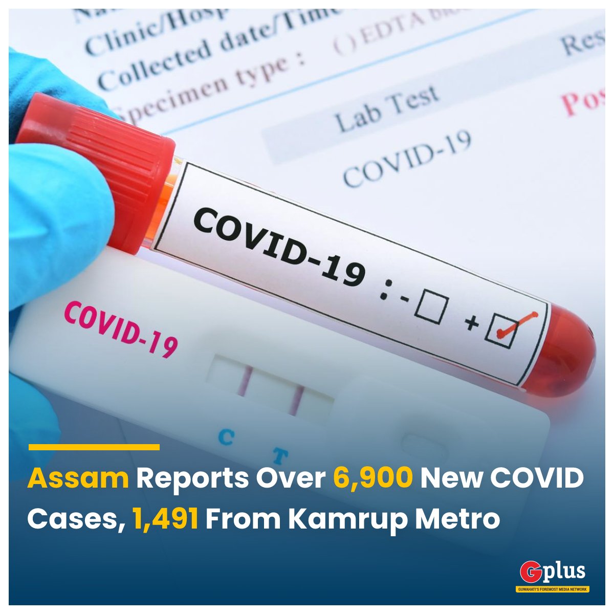 guwahatiplus's tweet photo. #BREAKING | 64,919 tests were conducted in #Assam on Jan 17 of which 6,982 have tested positive for #COVID19. 1,491 of these cases are from Kamrup M. 11 deaths were reported &amp; daily positivity rate is at 10.75%. This was informed by #Assam CM on his Twitter account.

#Guwahati https://t.co/wwUBhrtjv8