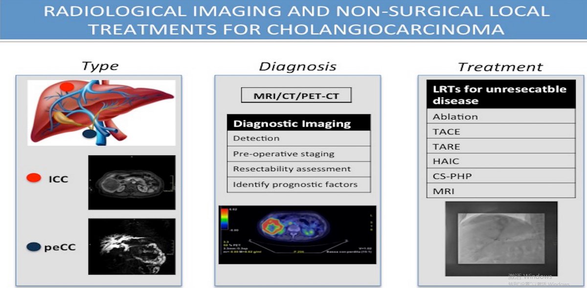 HepatomaRes's tweet photo. #livertwitter #GITwitter #MRI #CT A truly must-read on "Radiological imaging and non-surgical local treatments for cholangiocarcinoma". This is a master piece by Dr. Francesco De Cobelli's team. https://t.co/W8fVRK7W8t

@FDeCobelli @ShimaghavimiMD @LouisHSLau @vij_mukul https://t.co/hhTz0kfll0