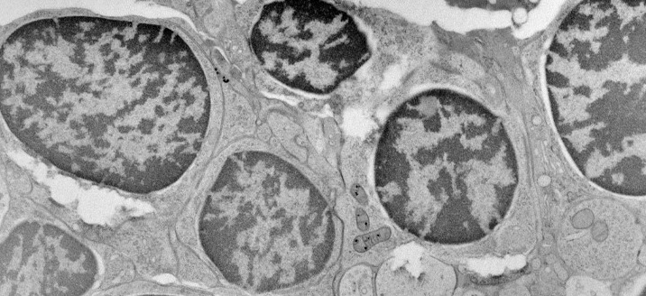 IGBMC's tweet image. #RecruitmentIGBMC // A team leader position is open in the field of cellular cryo electron tomography at IGBMC. 

Check out the offer here to get all the useful links and documents : bit.ly/33Jw5qw !