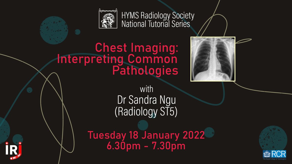 HYMS Radiology Society (@hymsradsoc) on Twitter photo Never miss that pneumothorax again: join us and Dr Sandra Ngu <a href="/Sngu10/">Sandra Ngu</a> on our Webinar on Chest Imaging: Interpreting Common Pathologies.
Sign up through our website hymsradsoc.com/events
☢️Tuesday 18 January 2022☢️ Never miss that pneumothorax again: join us and Dr Sandra Ngu <a href="/Sngu10/">Sandra Ngu</a> on our Webinar on Chest Imaging: Interpreting Common Pathologies.
Sign up through our website hymsradsoc.com/events
☢️Tuesday 18 January 2022☢️