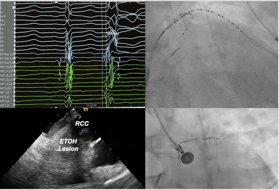 Penn Cardiology (PennCardiology) Twitter