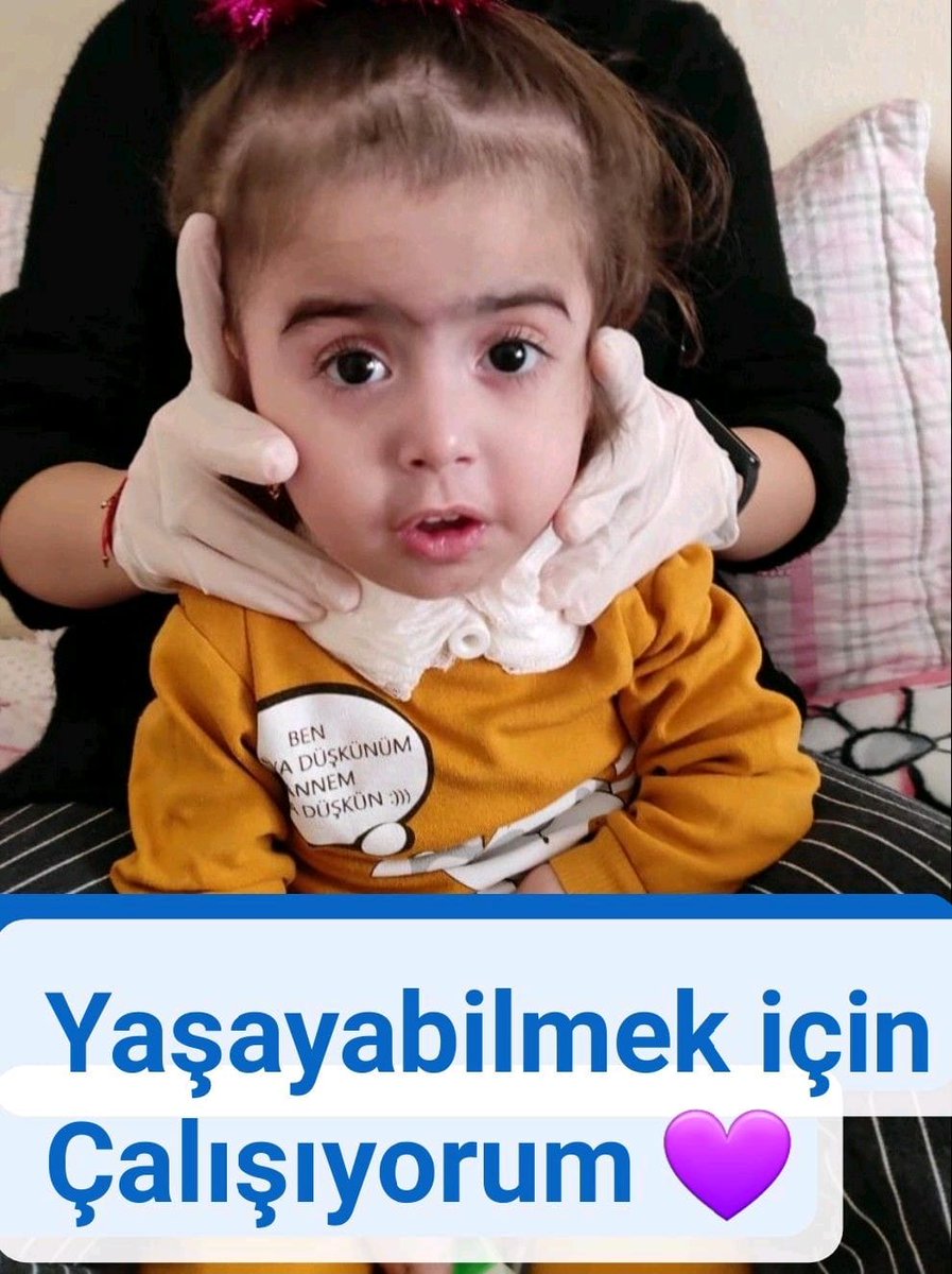 yagmurdeniz_sma's tweet photo. Yağmur Deniz'in ilacını alabilmesi için son 700 gram kaldı! Hayatta kalabilmek için vargücüyle çabalıyor. Lütfen siz de bağışlarınızla destek olun Yağmur'u ölüme terk etmeyin 🙏
NEFES YAZ 7021’E GÖNDER
1 SMS 👉20 TL BAĞIŞ
İban bağış için hesaplar bu linkte https://t.co/9vvKxSldvC https://t.co/ZF7nzay8nq