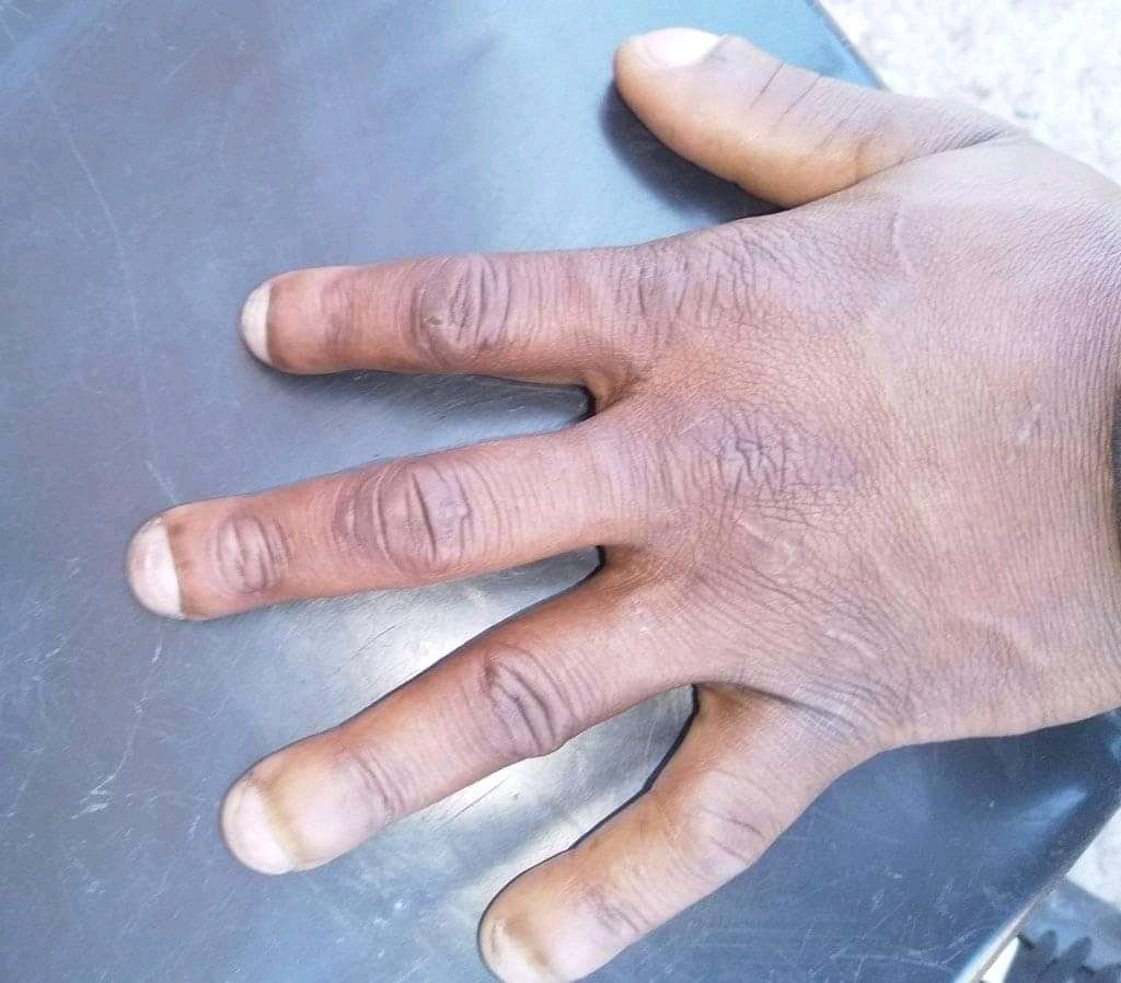 ChrisExcel102's tweet photo. Papa Action's if he was patient with Thembi..

Before.                                        After https://t.co/G5x8JwGAbq