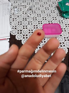 “Anne lütfen artık parmaklarımı delme"
#parmağımdelinmesin 
<a href="/anadoludiyabet/">🇹🇷🇹🇷ANADOLUDİYABET🇹🇷🇹🇷ADANA</a>
@rterdogan
@emineerdogan
<a href="/dbdevletbahceli/">Devlet Bahçeli</a>
<a href="/drfahrettinkoca/">Dr. Fahrettin Koca</a>
<a href="/jsarieroglu/">Jülide Sarıeroğlu 🇹🇷</a>
@avozlemzengin
<a href="/deryayanikashb/">Derya Yanık</a>
@hbturkoglu
<a href="/iyiparti/">İYİ Parti</a>
@herkesicinchp
<a href="/sgksosyalmedya/">SGK</a>.