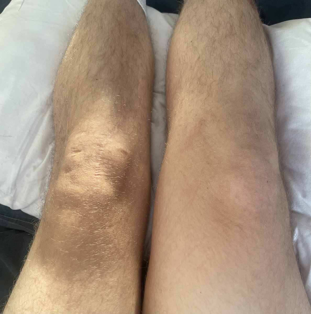 ⁴⁴corey tweet media