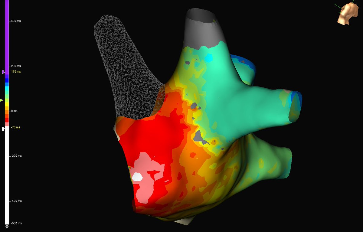 Tyler Hunt tweet media