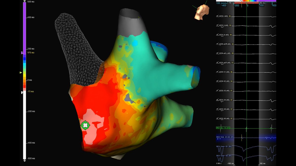 Tyler Hunt tweet media