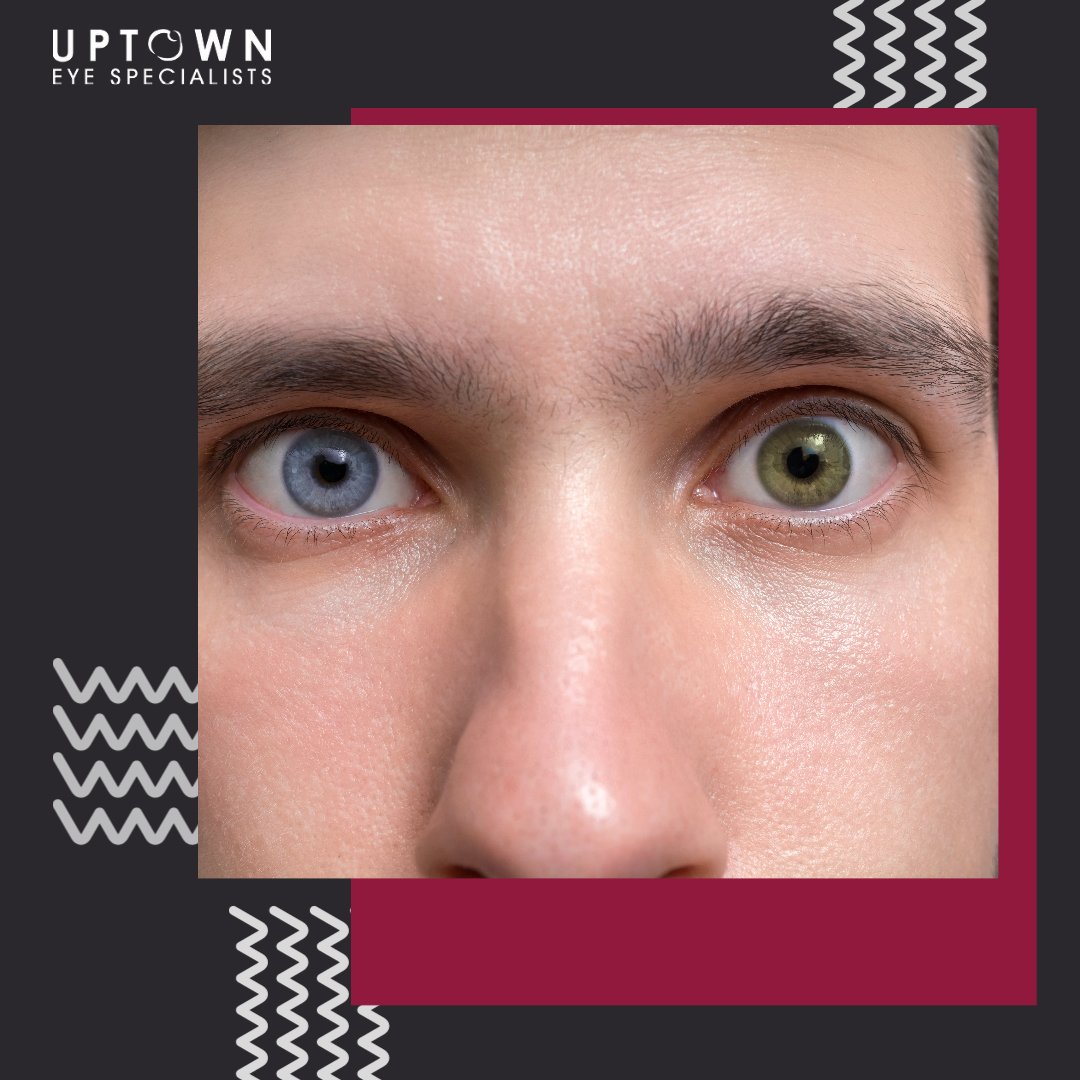 uptown_eye's tweet photo. Eye Fact: Heterochromia refers to a condition where eyes are two different colours!

#UptownEye #heterochromia #eyefactfriday https://t.co/As3IC8ZAcm