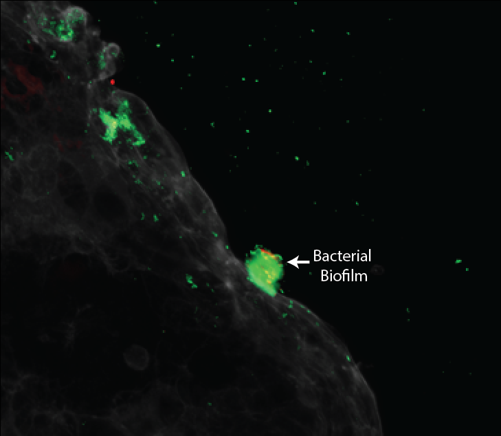 I am recruiting a grad student for Fall 2022. Come work with us <a href="/LKSIoV/">Li Ka Shing Institute of Virology</a>. We are investigating the pathogenesis of Crohn's-associated bacteria using approaches that combine genomics and biochemistry. For more details, check elhenawylab.com
A RT will be much appreciated!