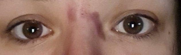 PSA: DO NOT BUY A PORE VACUUM- it will get stuck on your skin and it will leave your face bruised. A day in life folks
