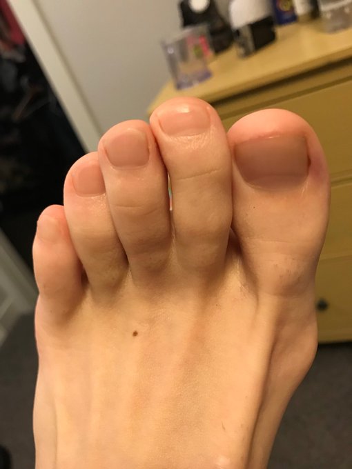 I need my toe lovers out there to help me with a very important question: Do my toes look suckable? 🤔 #maletoes<a href="/tag/maletoes"class="tags"><span>#maletoes</span></a><a href="/tag/maletoefetish"class="tags"><span>#maletoefetish</span></a>