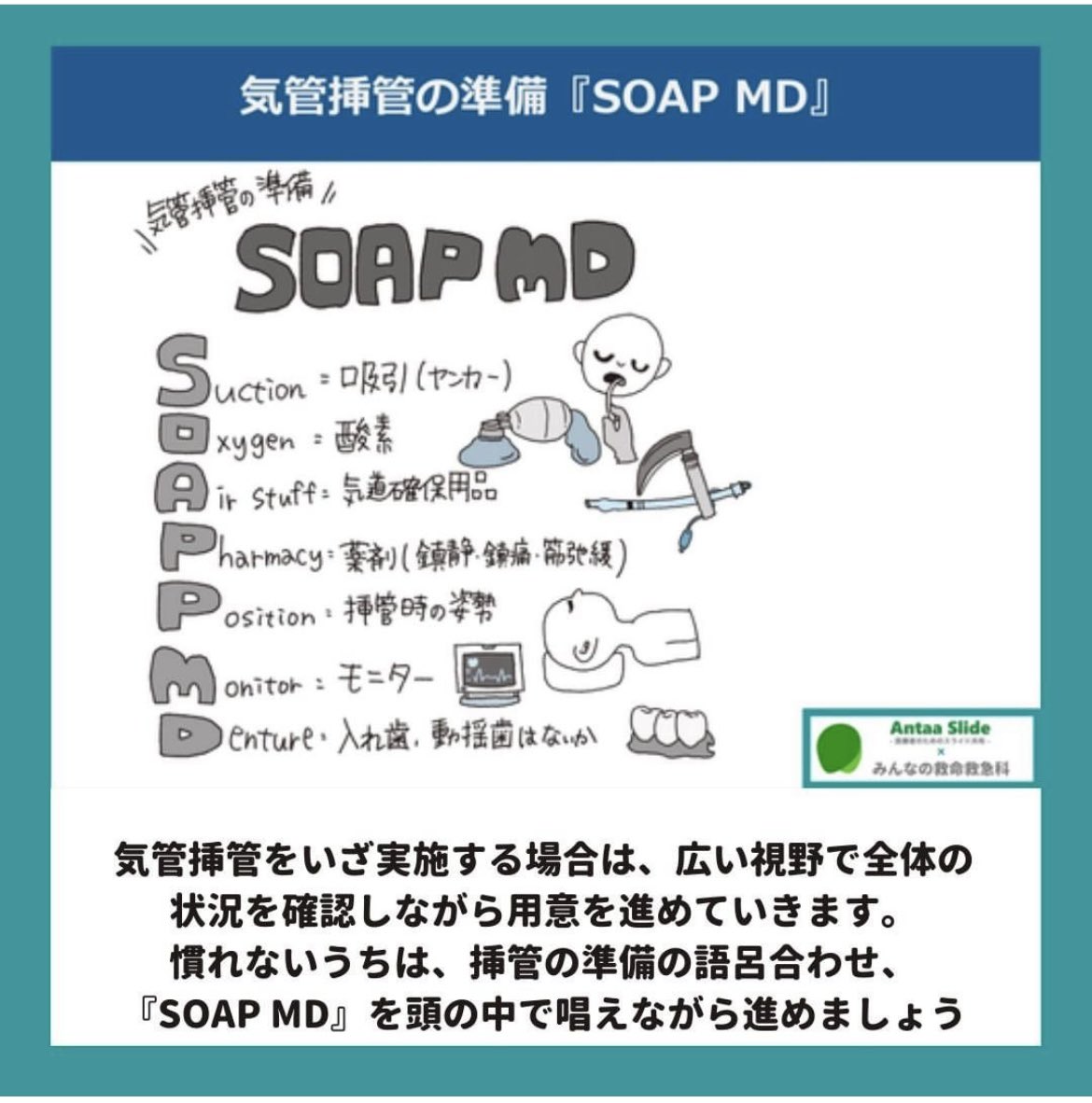 慣れないうちは、『SOAP MD』を頭の中で唱えながら気管挿管の準備を進めます。 挿管チューブの準備をする一連の流れで、スタイレットの挿入や、カフの破損がないかの確認をします。  カフ注入口へシリンジをしっかりと挿入して、カフへの空気注入、脱気を確認しておきま ..., image size:1170x1182