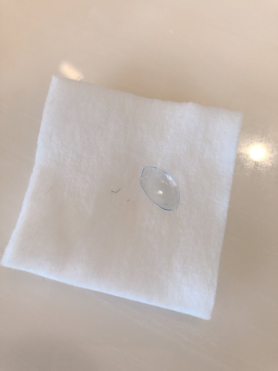 0817_kt's tweet photo. 目に残された片割れが眼科の先生によってピンセットで取り除かれました。
とても1人では外せない場所、瞼の裏辺りに隠れてました。
結局、診察料と感染予防の目薬で3000円もかかったし、時間もかかった💢  #デイリーズアクア コンフォートプラス トーリック
1day  #日本アルコン https://t.co/yHJE9m3729