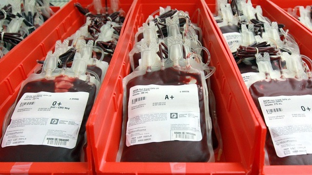 NewsDayZimbabwe's tweet photo. 🔴THE National Blood Services of Zimbabwe (NBSZ) said the country was running out of stocks for blood group “O”.
🔗https://t.co/phMwdDmcWA @wisdomdzungairi https://t.co/bDz0RFO5pZ