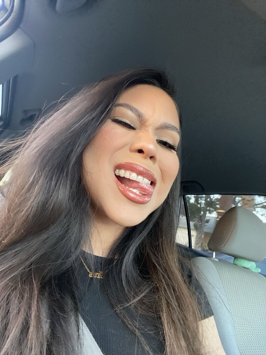 braceface 😬