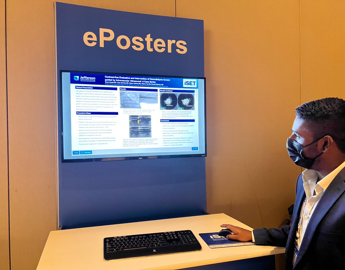 Varun Danda, MD (@varun_danda) on Twitter photo Very excited to have presented the <a href="/JeffersonRads/">Jefferson Radiology</a> contrast-free fistulagram experience at <a href="/ISETNews/">ISET</a> #ISET2022. Thank you <a href="/SMaratto/">Sean Maratto</a> <a href="/allison_tan_md/">Allison Tan, MD</a> @DrRobertAdamo <a href="/RonaldWinokurMD/">Ronald Winokur, MD, FSIR, FAVLS, RPVI</a> for the great cases and support! <a href="/SIRRFS/">SIR RFS</a> <a href="/IrigJefferson/">Jefferson IRIG</a> #IRad #twittIR Very excited to have presented the <a href="/JeffersonRads/">Jefferson Radiology</a> contrast-free fistulagram experience at <a href="/ISETNews/">ISET</a> #ISET2022. Thank you <a href="/SMaratto/">Sean Maratto</a> <a href="/allison_tan_md/">Allison Tan, MD</a> @DrRobertAdamo <a href="/RonaldWinokurMD/">Ronald Winokur, MD, FSIR, FAVLS, RPVI</a> for the great cases and support! <a href="/SIRRFS/">SIR RFS</a> <a href="/IrigJefferson/">Jefferson IRIG</a> #IRad #twittIR