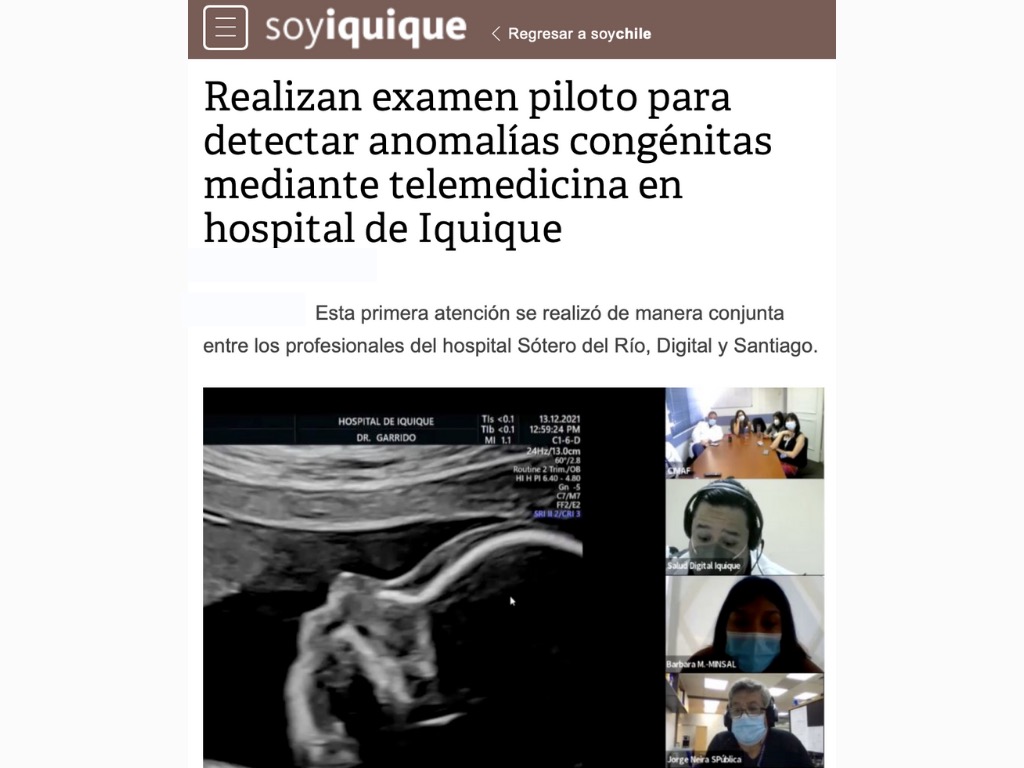 HospitalDigital's tweet photo. 📌Diario @soychilecl destaca a Pichipu, atención de #TeleMedicina sincrónica entre @HospitalIquique y @SoterodelRio, el que gracias al soporte de #HospitalDigital pusieron en marcha piloto para detectar anomalías congénitas mayores.

Detalles👉https://t.co/qH9imQdk6N https://t.co/47aEfQtyrb
