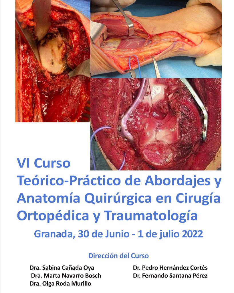 Happy to announce the VI course of upper limb approach and surgical anatomy in Granada…. 
We expect you to join us to perform every upper limb approach and its anatomical relationships.