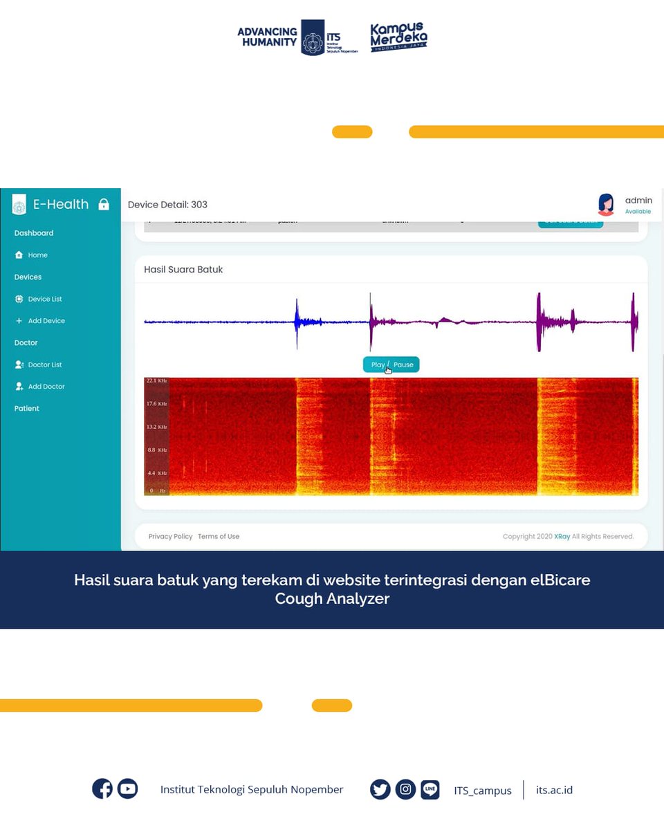 its_campus's tweet photo. Dhany menjelaskan bahwa elBicare Cough Analyzer dilengkapi dengan mikrofon bersensor tipis dan kecil yang berguna untuk menangkap suara di sekitar alat. 

Simak berita selengkapnya di https://t.co/faUnKisXYG

#ITSCampus #ITSSurabaya #Covid #Covid19 #Batuk #Deteksi #Infeksi https://t.co/siTFZ3U6hz