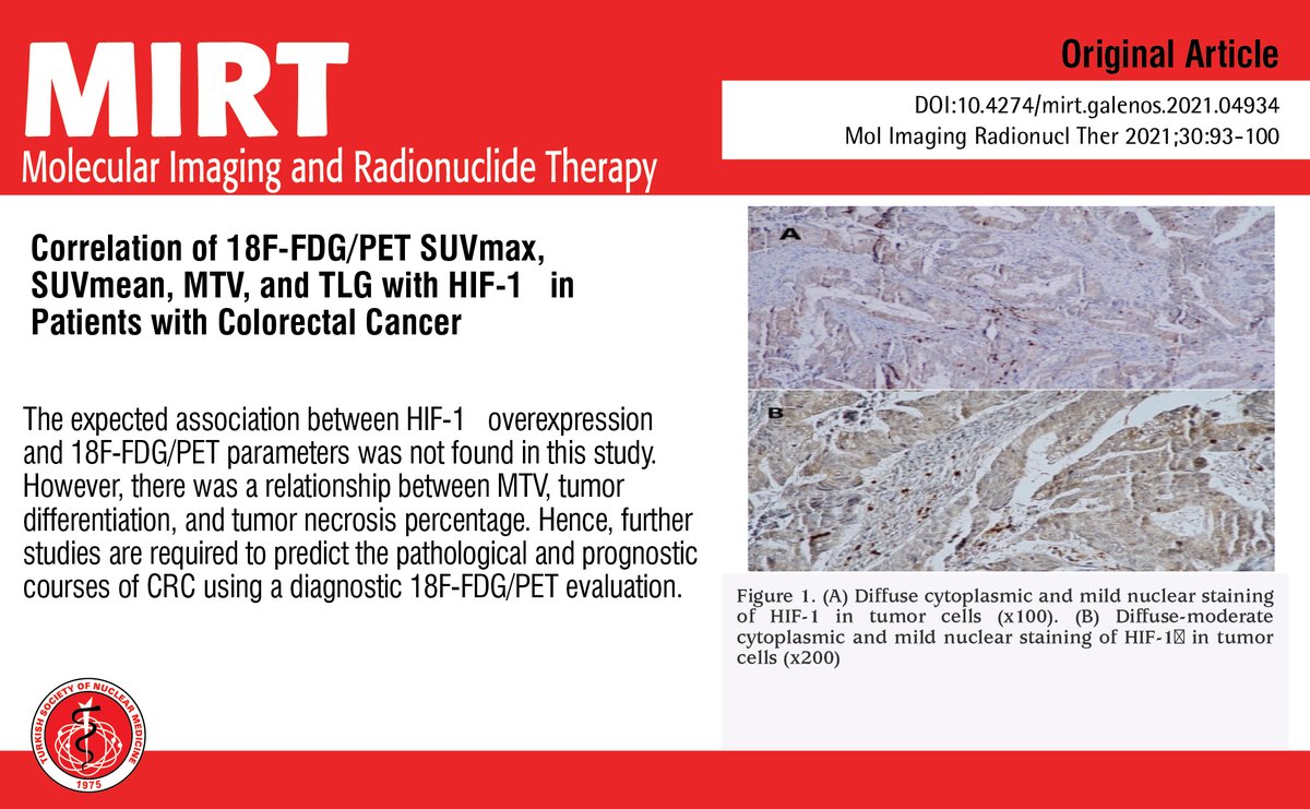 MIRTOfficial's tweet photo. Correlation of 18F-FDG/PET SUVmax, SUVmean, MTV, and TLG with HIF-1α in Patients with Colorectal Cancer
You can see the free full text of the research by Zümrüt Arda Kaymak et al.
Link : https://t.co/2zoXrCttuh
#Hypoxia #inducible #factor1 #colorectal #cancer https://t.co/TIKkSoLedI