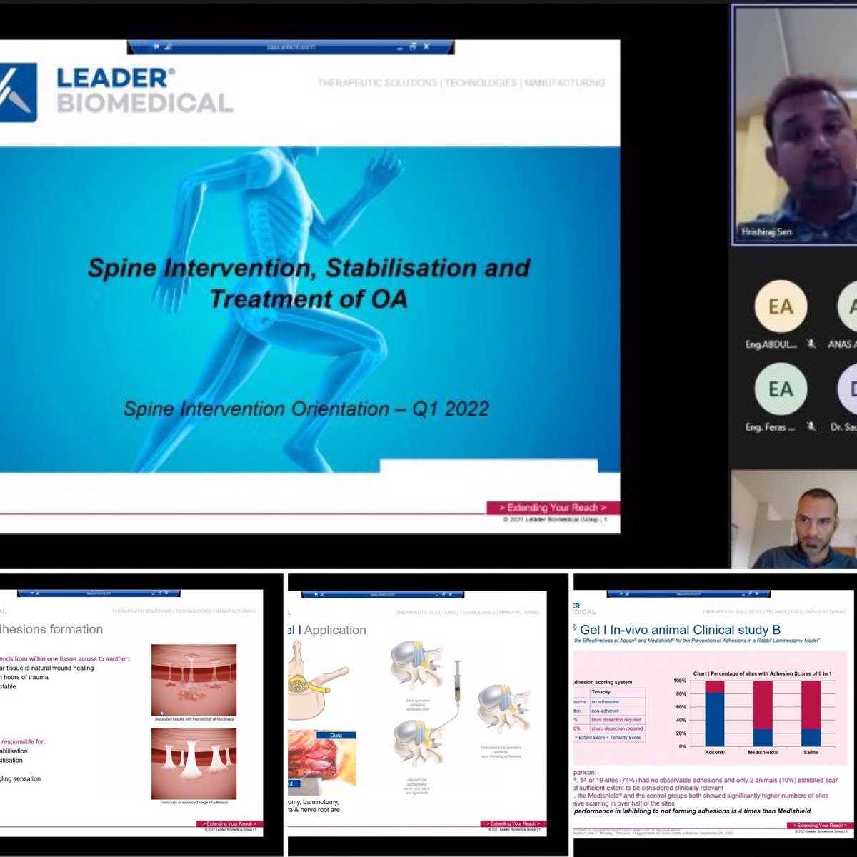 #neverstoplearning #newweeknewgoals #newweek #newlearnings 
Another #trainingsession by Dr. Hrishiraj Sen and Stefano Papa this time focusing on #spinecare #spineintervention #adcongel #antiadhesion #fbss and #osteoarthritis #treatments
DM or mail learning@leaderbiomedical.com