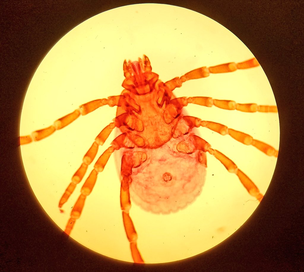 vivelesSVT's tweet photo. Maladies vectorielles : avez-vous déjà vu une tête de tique au microscope ? #rostre #maladiedeLyme https://t.co/3boofMXTut
