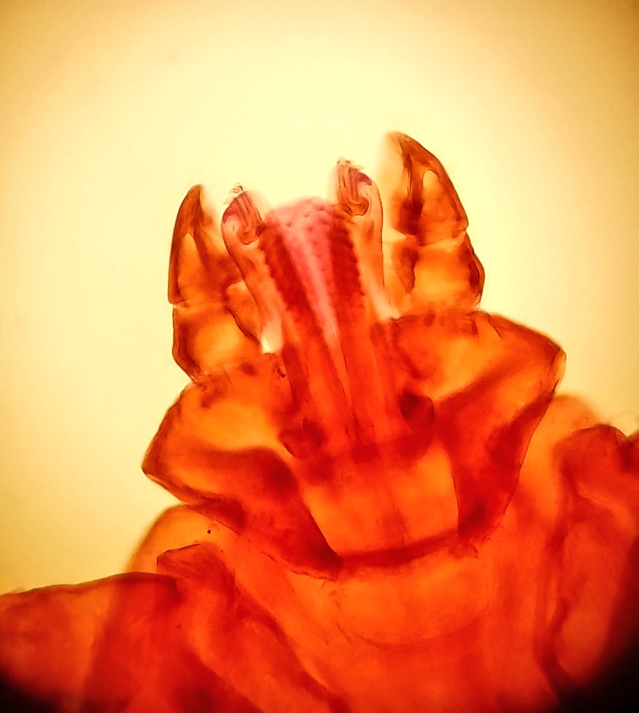 vivelesSVT's tweet photo. Maladies vectorielles : avez-vous déjà vu une tête de tique au microscope ? #rostre #maladiedeLyme https://t.co/3boofMXTut