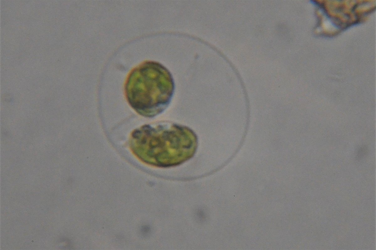 estacanicazul's tweet photo. En este estanque de San Diego #coruña hay numerosas #Asterococcus son vegetales con un cloroplasto viven dentro de una burbuja de mucílago se reproducen dentro y luego se liberan y nadan con sus dos flagelos
Aquí se ven las fases de reproducción
#biodiversidadurbana
⬇️ video https://t.co/5Yp6cYHoOC